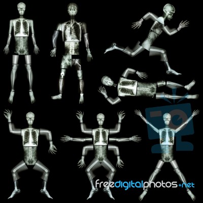 Collection Of Human Skeleton (x-ray Whole Body : Skull Head Face Neck Spine Shoulder Arm Forearm Elbow Wrist Hand Finger Thorax Lung Heart Abdomen Pelvis Leg Knee Joint Thigh Foot Ankle Heel ) Stock Photo