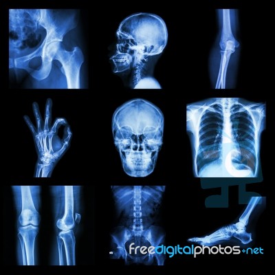 Collection X-ray Part Of Human Stock Photo