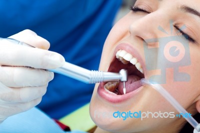 Cute Young Woman At The Dentist. Mouth Checkup Stock Photo