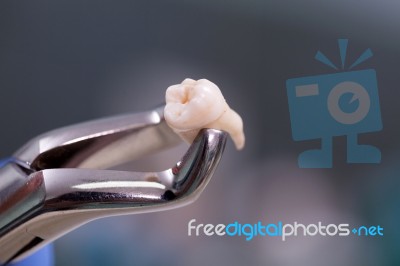 Dental Equipment Holding An Extracted Tooth Stock Photo