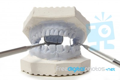 Dental Examining Stock Photo