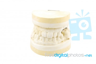 Dental Prosthesis Study Model On White Stock Photo