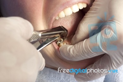 Dentist Stock Photo