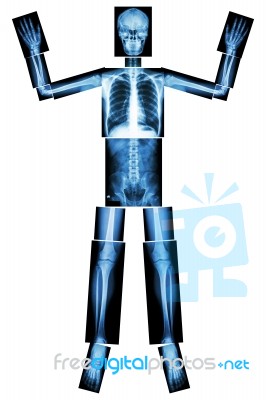 Give Up Ebola. (human Bone Raise The Hand) (whole Body : Head Neck Spine Shoulder Arm Elbow Forearm Wrist Hand Finger Thorax Heart Lung Back Abdomen Pelvis Hip Thigh Leg Knee Foot Ankle Heel) Stock Photo