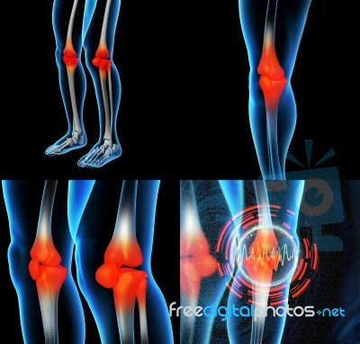 Human Knee Pain With The Anatomy Of A Skeleton Leg Stock Image