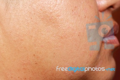 Human Skin Texture Stock Photo