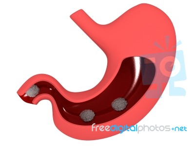 Human Stomach Stock Image