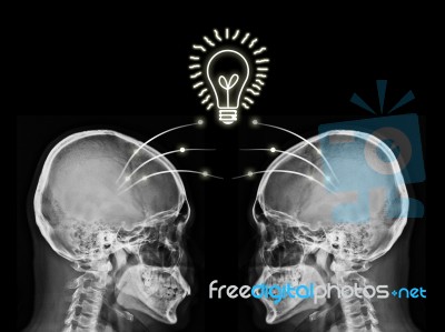 Idea From X Ray Stock Photo