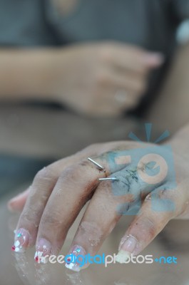 Injured Finger Close Up Stock Photo