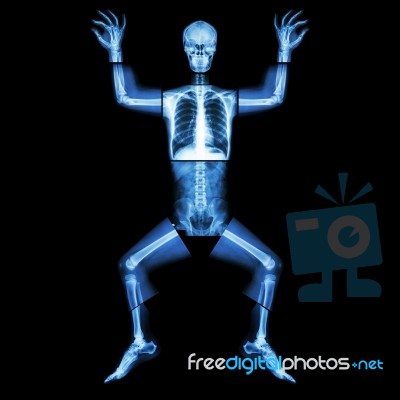 Jigsaw Human X-ray ( Whole Body : Head Skull Face Neck Spine Shoulder Arm Elbow Joint Forearm Wrist Hand Finger Chest Thorax Heart Lung Rib Abdomen Back Pelvis Hip Thigh Knee Leg Ankle Foot Heel Toe ) Stock Photo
