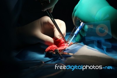 Macro Shot Of An Infant Lung Surgery Stock Photo