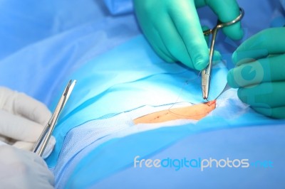 Macro Shot Of Doctors Making A Suture In Operation Room.  Focus Stock Photo
