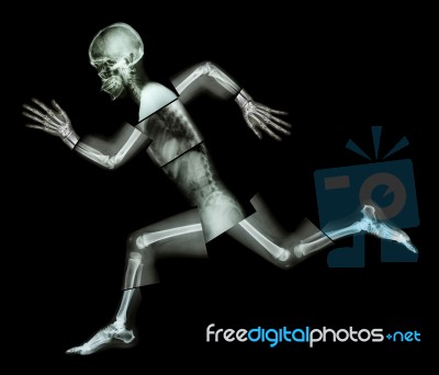 Marathon (human Bone Is Running) ,(whole Body X-ray : Head ,neck ,shoulder ,arm ,elbow ,forearm ,hand ,finger ,joint ,thorax ,abdomen ,back,pelvis ,hip ,thigh ,leg ,knee ,foot ,heel) Stock Photo