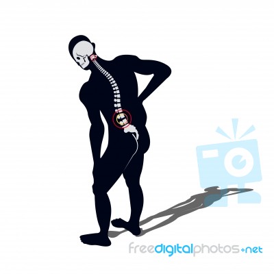Medical Concept Illustration Of Musculotendinous Strain Back Ache Or Lumbar Pain Stock Image