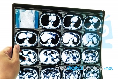 Medical Diagnosis Background. Ct Scan And Hand Stock Photo
