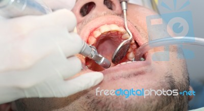 Mouth Bleeding At The Dentist Office Stock Photo