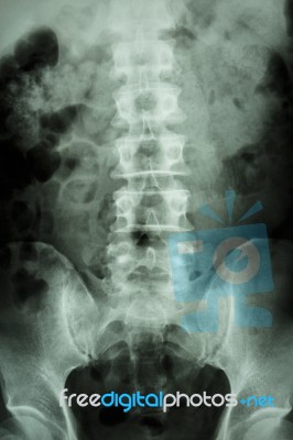Normal Human Lumbar-sacrum Spine Stock Photo