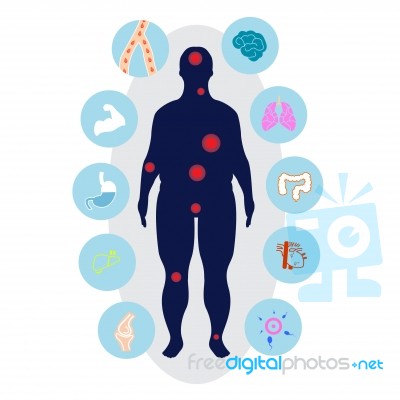 Obesity Related Diseases And Prevention Stock Image