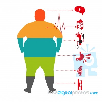 Obesity Related Diseases ,man Health Info Graphic. Fat And Health Man Stock Image