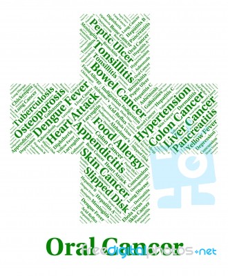 Oral Cancer Shows Poor Health And Afflictions Stock Image