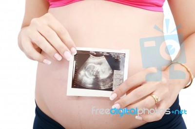 Pregnant Lady Showing Ultrasound Stock Photo