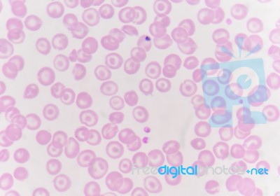 Red Blood Cells With White Blood Cells Background Stock Photo