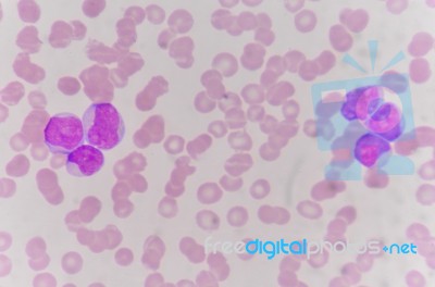 Red Blood Cells With White Blood Cells Background Stock Photo