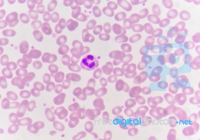 Red Blood Cells With White Blood Cells Background Stock Photo