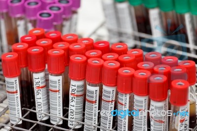 Sample Blood Tubes In Labratory Stock Photo