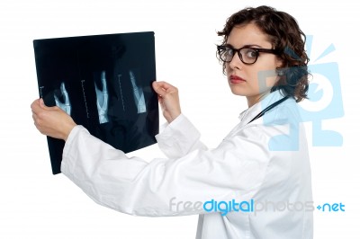 Serious Female Doctor Showing The X-ray Sheet Stock Photo