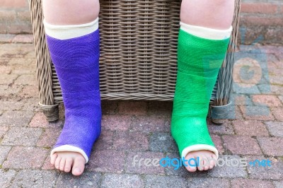 Sitting Boy With Two Colored Gypsum Legs Stock Photo