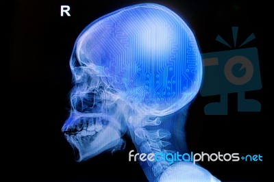 Skull X-rays Image With  Computer Chip And Circuit Stock Photo
