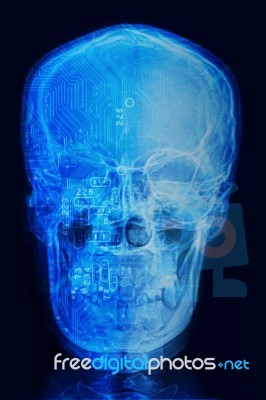 Skull X-rays Image With  Computer Chip And Circuit Mainboard Stock Photo