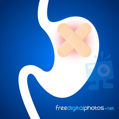 Stomach Ulcers Stock Image