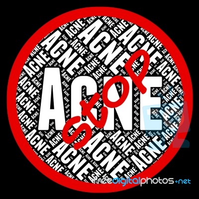 Stop Acne Means Warning Sign And Caution Stock Image