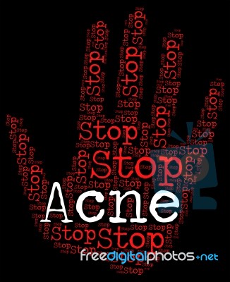 Stop Acne Shows Warning Sign And Blackheads Stock Image