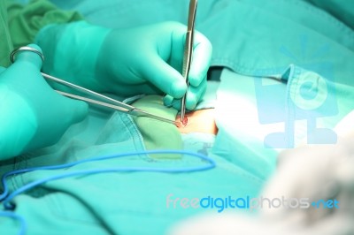 Surgeon Hands Suturing An Hernia Stock Photo