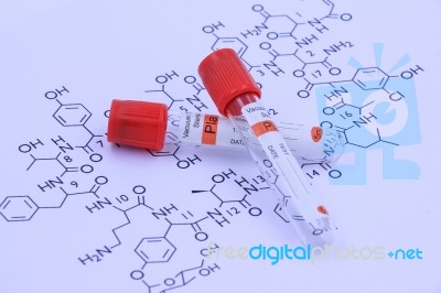 Test Tube Stock Photo