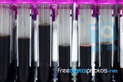 Tubes Blood Sample In Rack Stock Photo