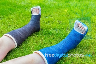 Two Gypsum Legs Of Boy On Grass Stock Photo