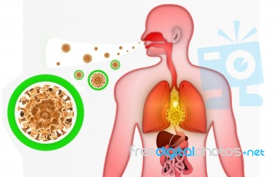 Virus Infection Stock Image Virus Infection Stock Image