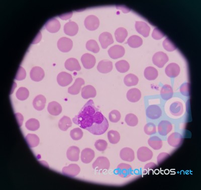 White Blood Cells Stock Photo