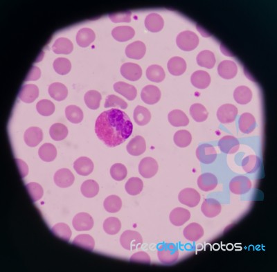 White Blood Cells Stock Photo