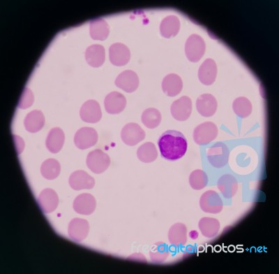 White Blood Cells Stock Photo