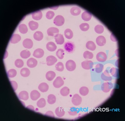 White Blood Cells Stock Photo