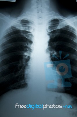 X-ray Body Scan Stock Photo