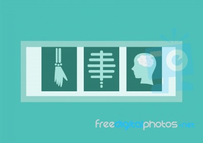 X-ray Films In Flat Style Stock Image