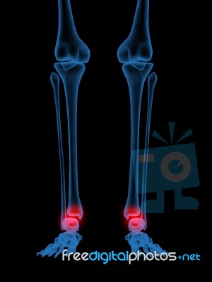 X-Ray Of Human Ankle Stock Photo