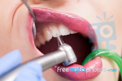 Young Girl Having Dental Check Up Stock Photo