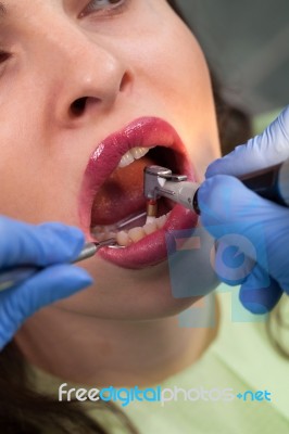 Young Girl Having Dental Check Up Stock Photo